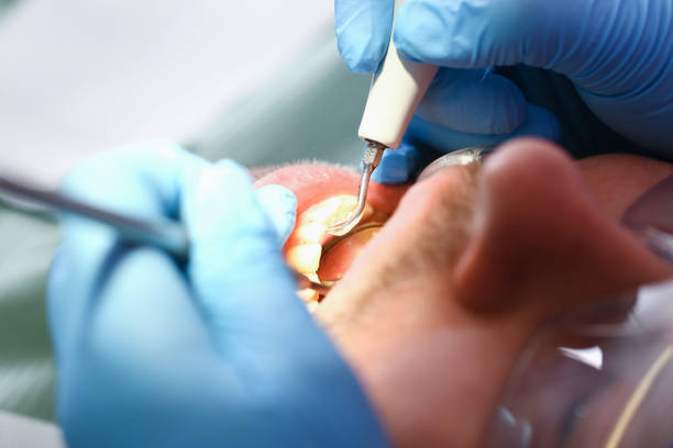 Best Walk-In Emergency Dental Services in Reliez Valley, CA
